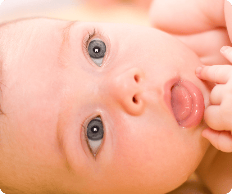 Mentes abiertas: abordaje del frenillo sublingual de 0 a 1 años